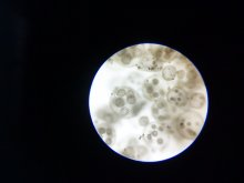 Volvox aureus / а вот такие необычные колонии