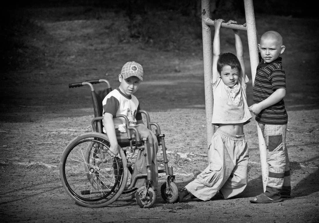 Инвалиды детства 3. Фотографии детей инвалидов. Инвалид детства. Дети инвалиды фото. Три друга дети.